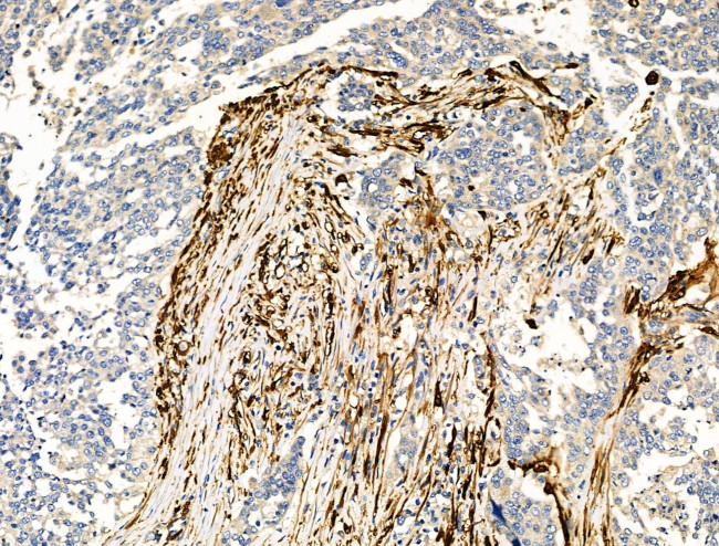 TAGLN Antibody in Immunohistochemistry (Paraffin) (IHC (P))