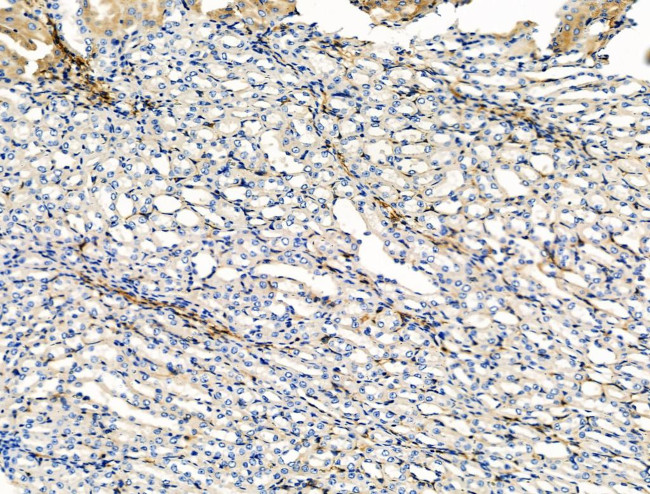 TAGLN Antibody in Immunohistochemistry (Paraffin) (IHC (P))