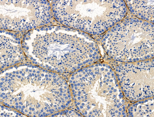 TAGLN Antibody in Immunohistochemistry (Paraffin) (IHC (P))