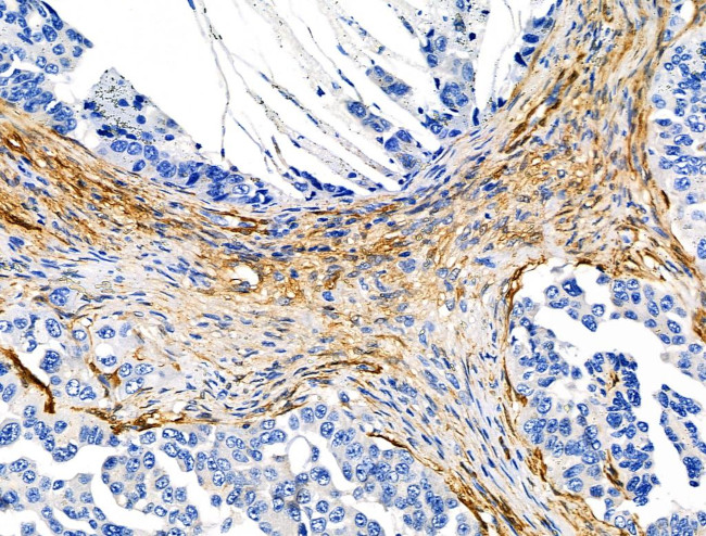 TAGLN Antibody in Immunohistochemistry (Paraffin) (IHC (P))