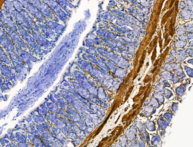 TAGLN Antibody in Immunohistochemistry (Paraffin) (IHC (P))