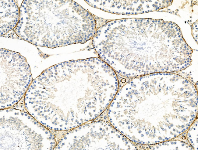 TAGLN Antibody in Immunohistochemistry (Paraffin) (IHC (P))