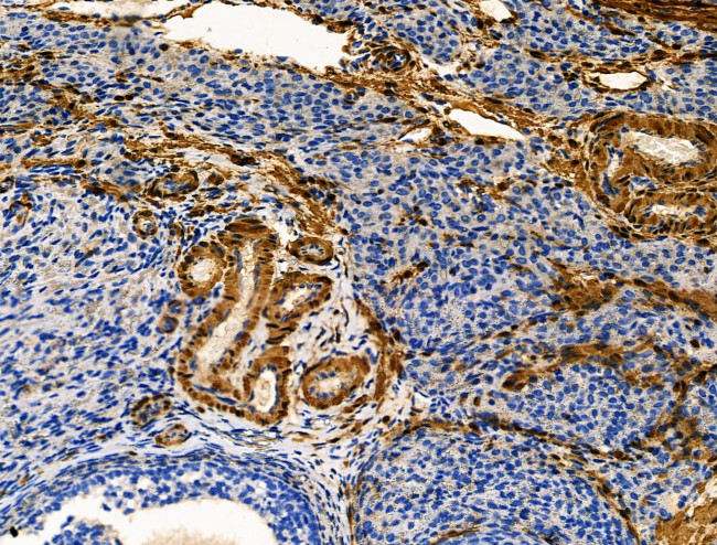 TAGLN Antibody in Immunohistochemistry (Paraffin) (IHC (P))