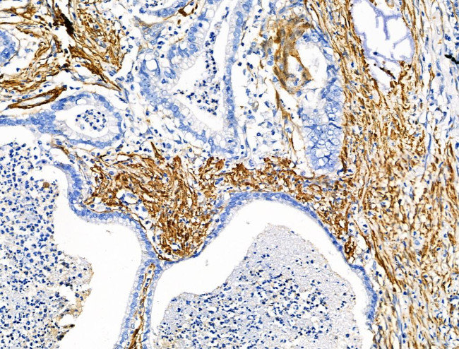 TAGLN Antibody in Immunohistochemistry (Paraffin) (IHC (P))