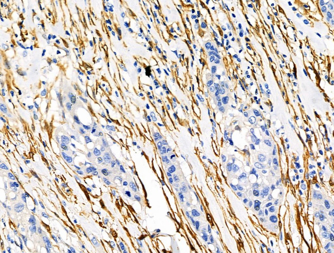 TAGLN Antibody in Immunohistochemistry (Paraffin) (IHC (P))