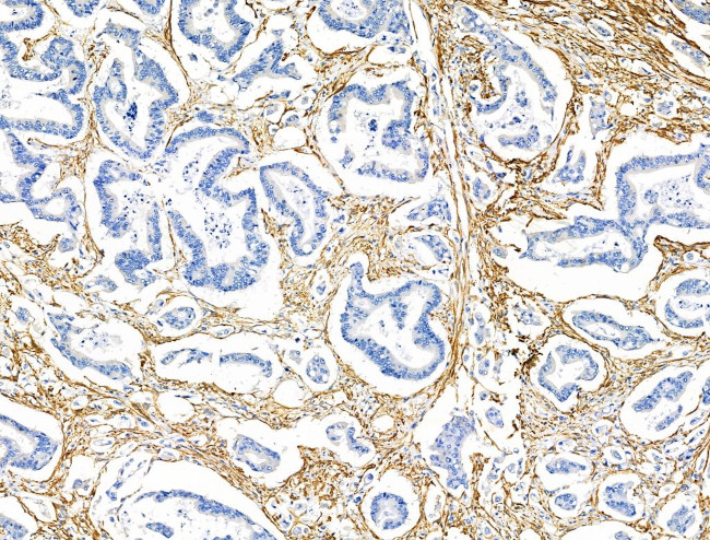 TAGLN Antibody in Immunohistochemistry (Paraffin) (IHC (P))