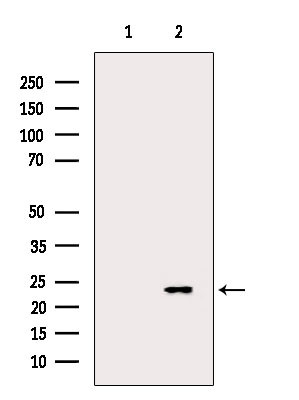 TAGLN Antibody in Western Blot (WB)