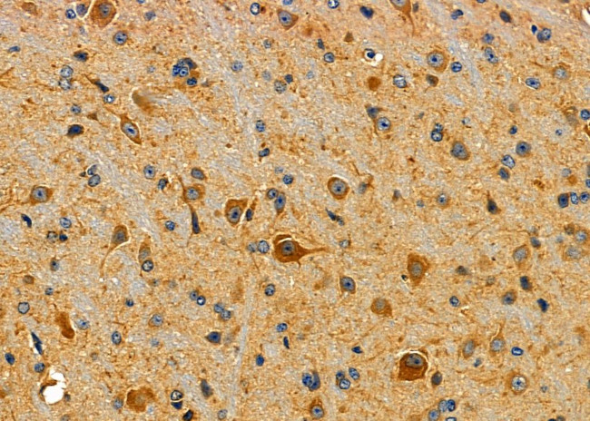 SMURF2 Antibody in Immunohistochemistry (Paraffin) (IHC (P))