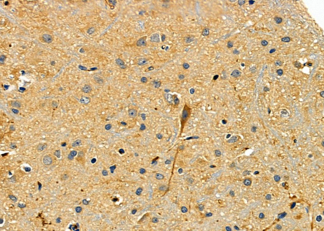 SMURF2 Antibody in Immunohistochemistry (Paraffin) (IHC (P))