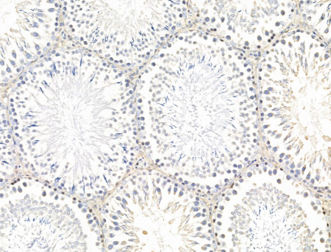 SSX2IP Antibody in Immunohistochemistry (Paraffin) (IHC (P))