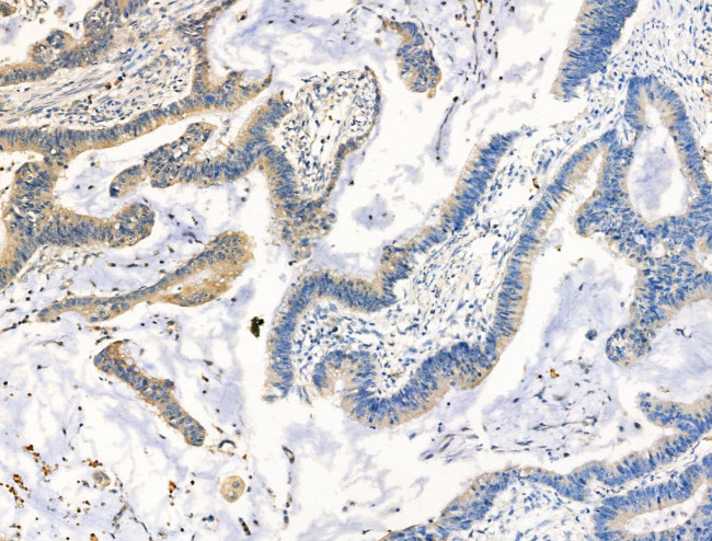 STATH Antibody in Immunohistochemistry (Paraffin) (IHC (P))