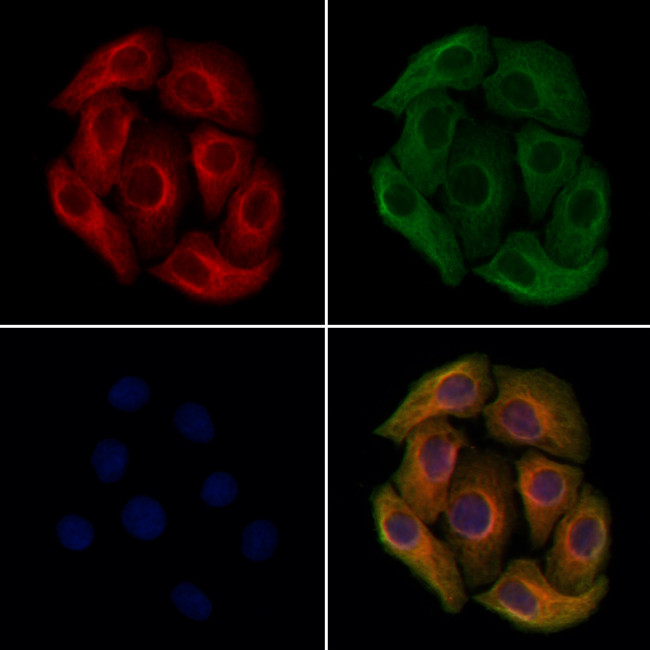 PLS3 Antibody in Immunocytochemistry (ICC/IF)