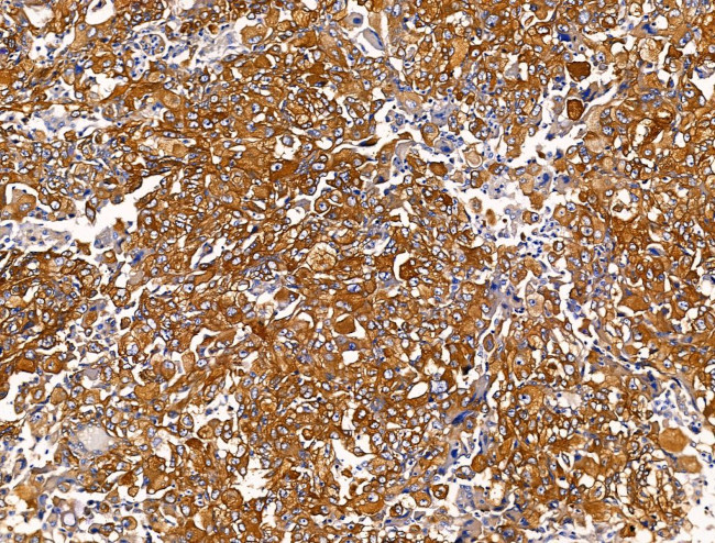 PLS3 Antibody in Immunohistochemistry (Paraffin) (IHC (P))