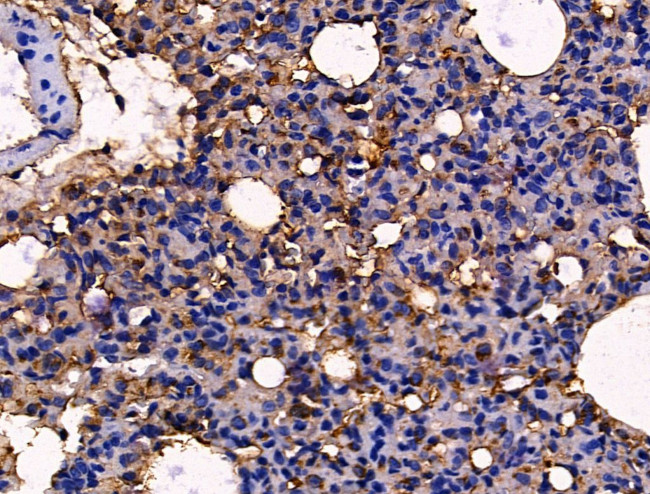 PLS3 Antibody in Immunohistochemistry (Paraffin) (IHC (P))