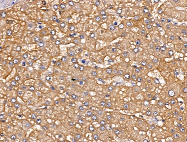 PLS3 Antibody in Immunohistochemistry (Paraffin) (IHC (P))