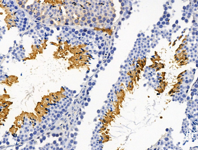 PLS3 Antibody in Immunohistochemistry (Paraffin) (IHC (P))