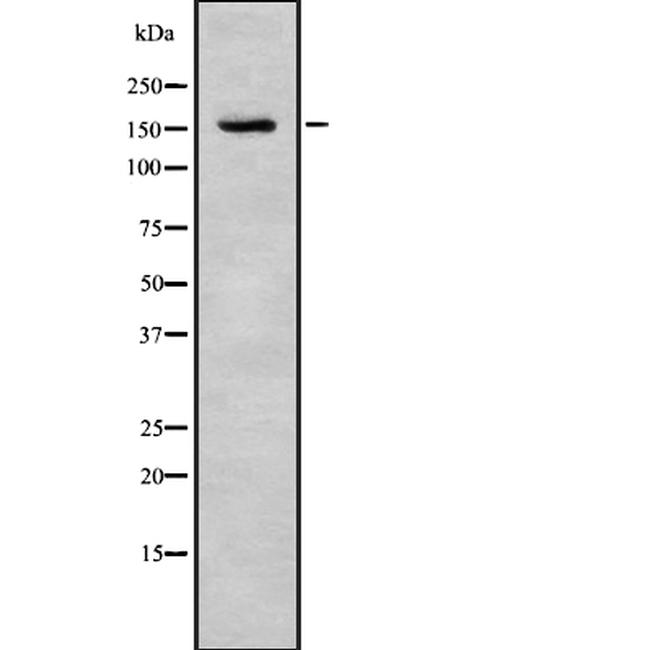 Tensin 3 Antibody in Western Blot (WB)