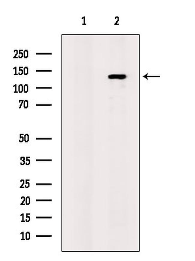 CD202b (TIE2) Antibody in Western Blot (WB)