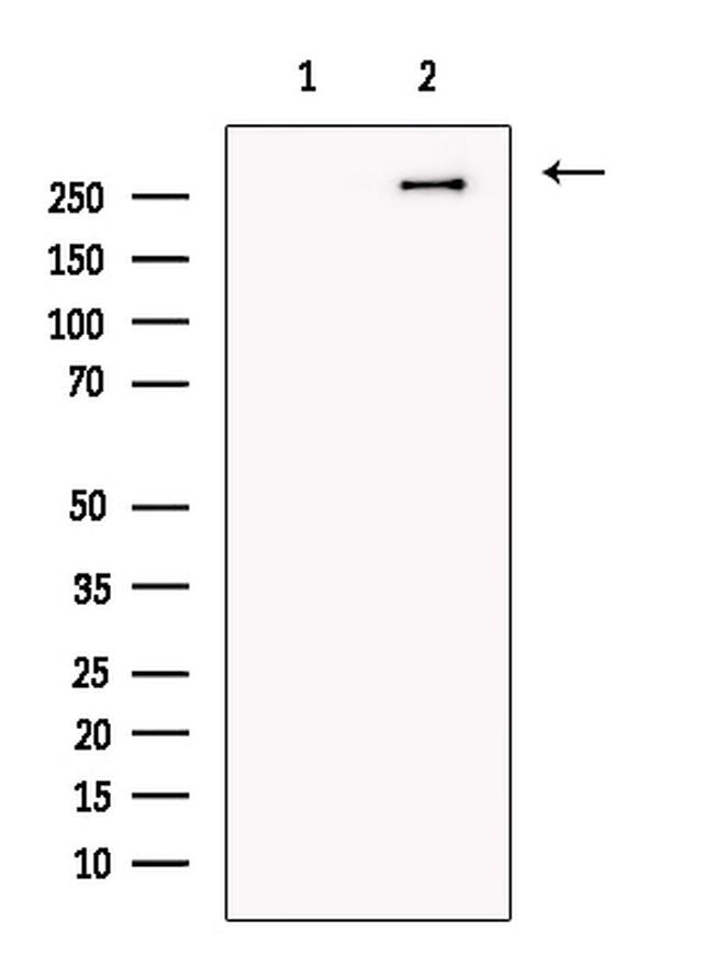 TCHH Antibody in Western Blot (WB)