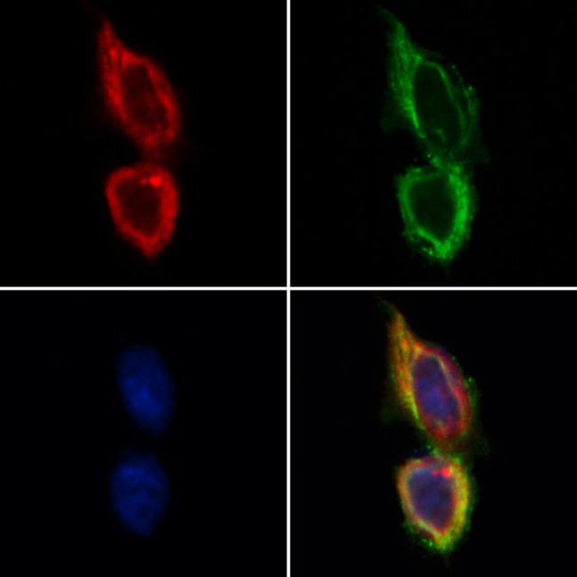 TSC1 Antibody in Immunocytochemistry (ICC/IF)