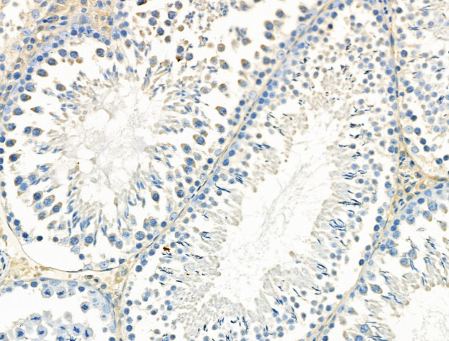 TSC1 Antibody in Immunohistochemistry (Paraffin) (IHC (P))