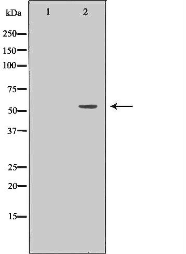 TrxR2 Antibody in Western Blot (WB)