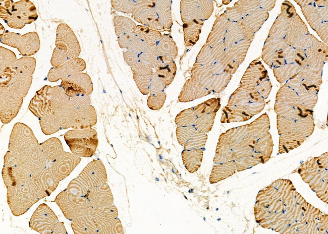 WARS Antibody in Immunohistochemistry (Paraffin) (IHC (P))