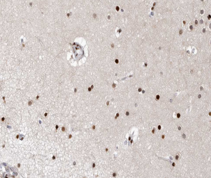 XPA Antibody in Immunohistochemistry (Paraffin) (IHC (P))