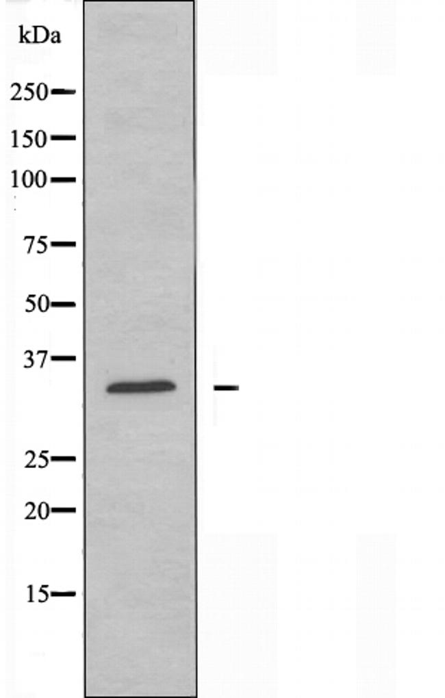 YOD1 Antibody in Western Blot (WB)