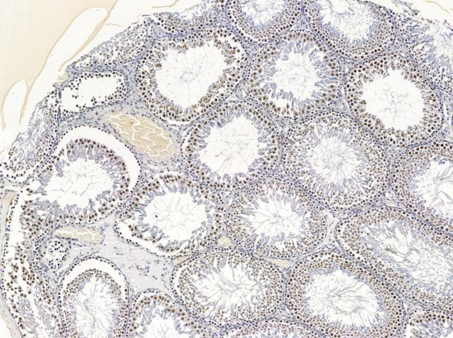 ZEB1 Antibody in Immunohistochemistry (Paraffin) (IHC (P))