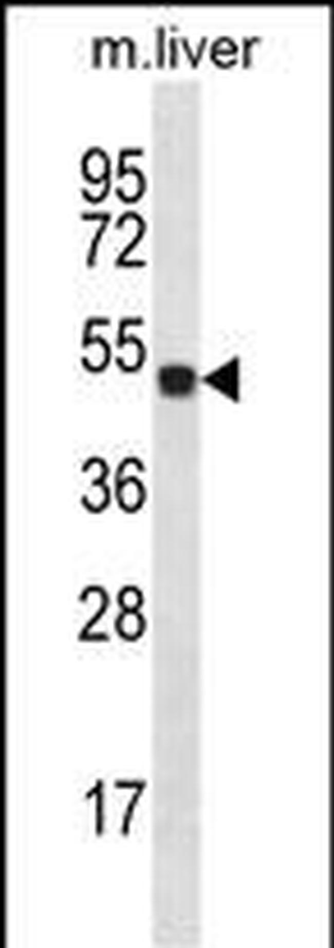 HOXD10 Antibody in Western Blot (WB)