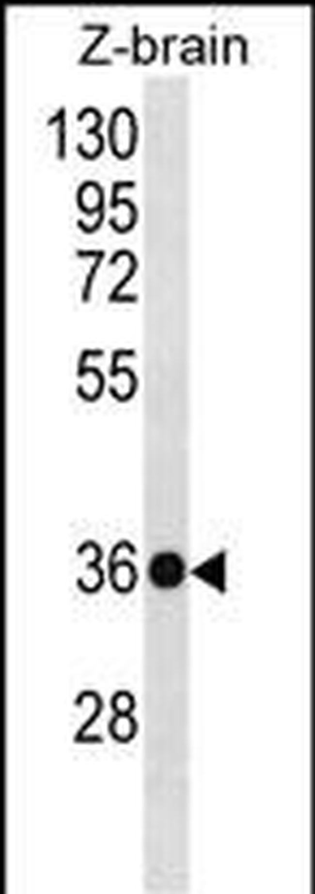 HOXD10 Antibody in Western Blot (WB)