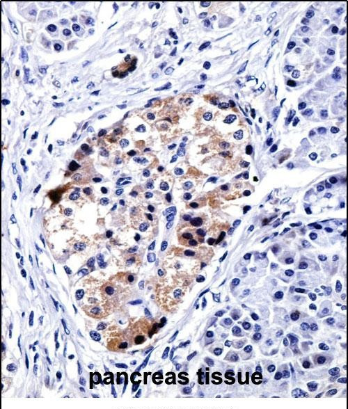 VAMP3 Antibody in Immunohistochemistry (Paraffin) (IHC (P))