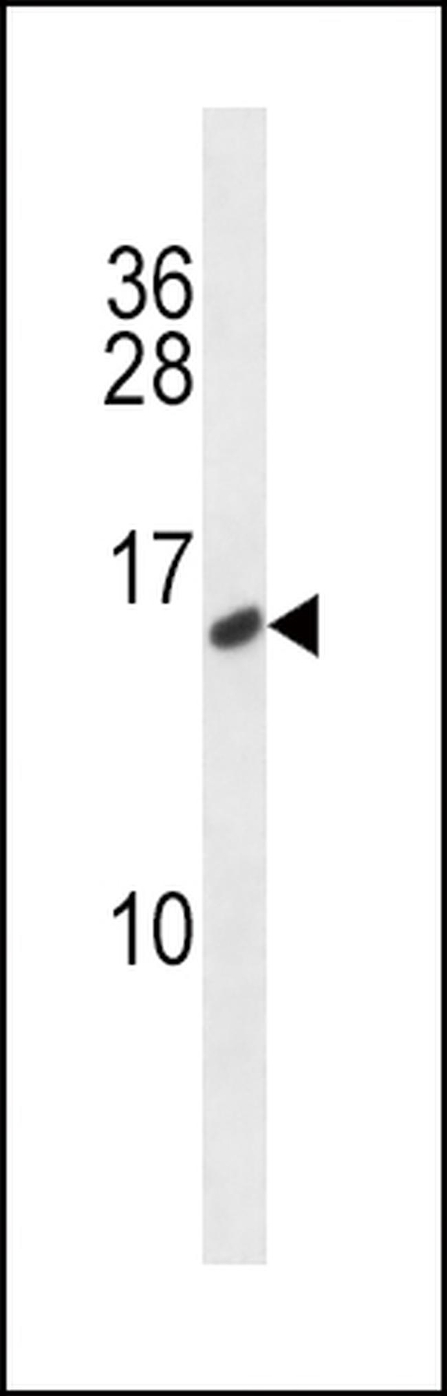 Calcitonin Antibody in Western Blot (WB)