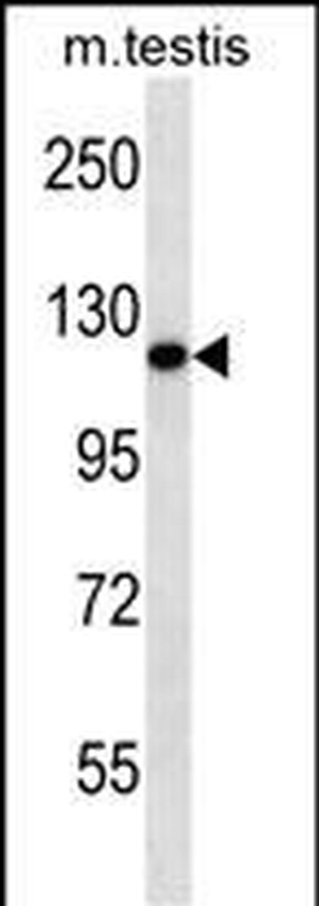 ERN2 Antibody in Western Blot (WB)