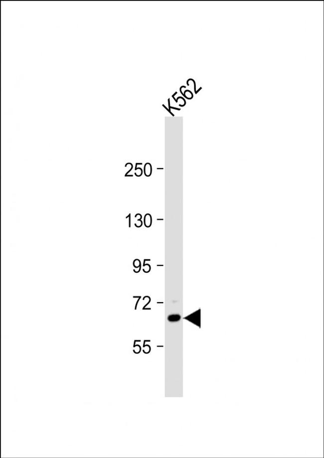 TEC Antibody in Western Blot (WB)