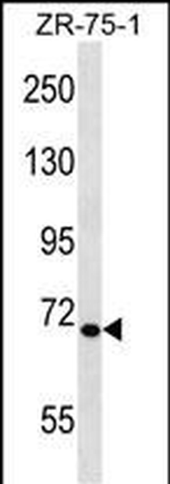 TEC Antibody in Western Blot (WB)