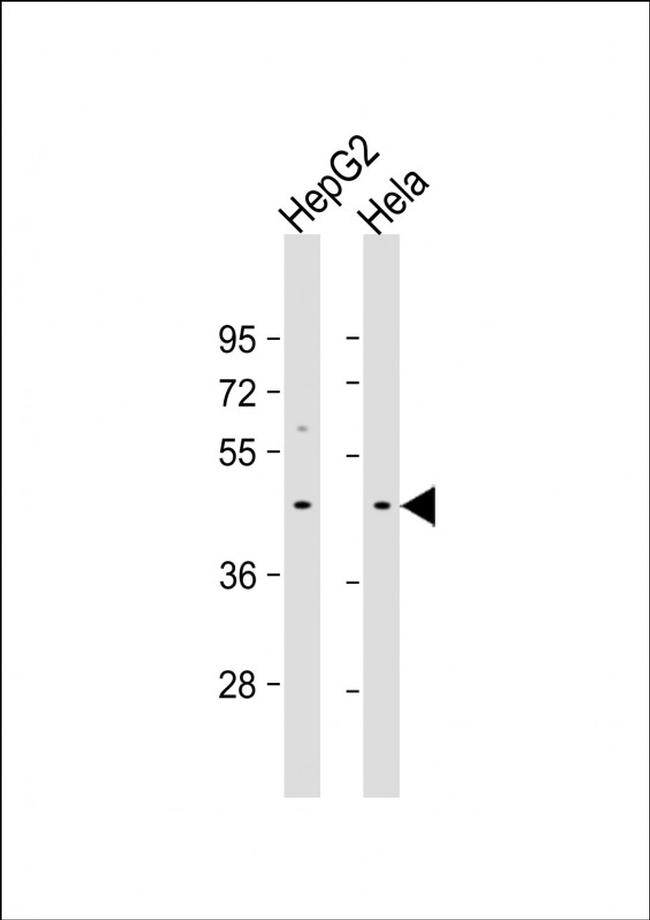 GIPC3 Antibody in Western Blot (WB)