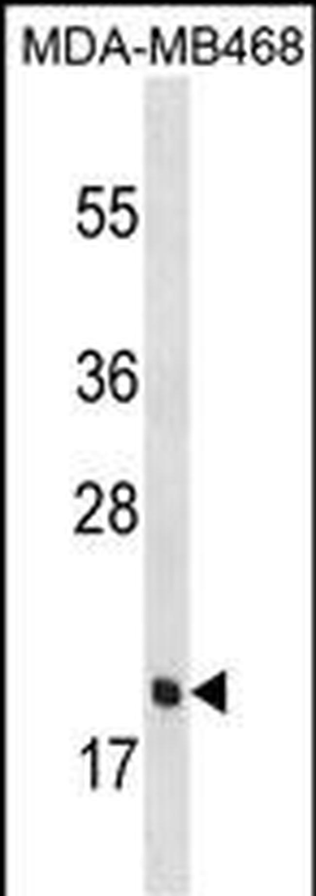 PGLYRP1 Antibody in Western Blot (WB)