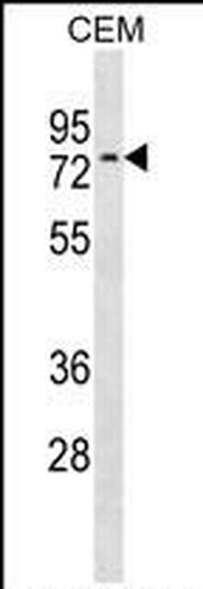 NRXN3 Antibody in Western Blot (WB)