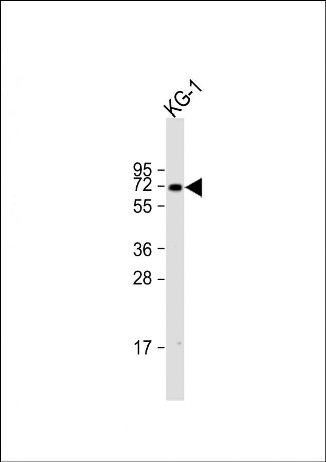 ZNF93 Antibody in Western Blot (WB)