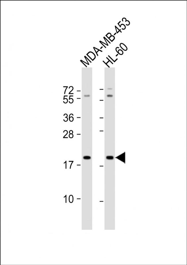 ZNF740 Antibody in Western Blot (WB)