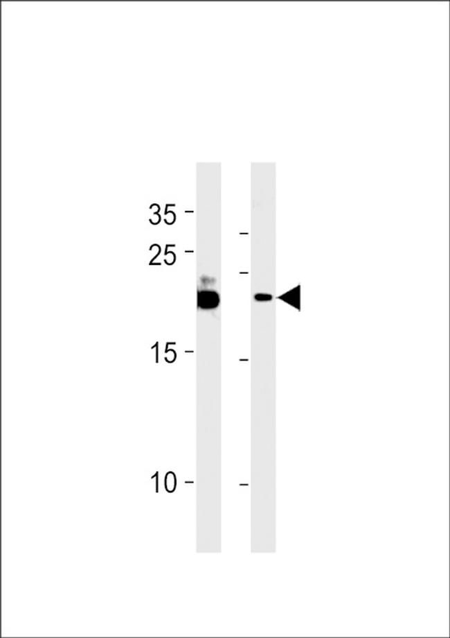 C13orf30 Antibody in Western Blot (WB)