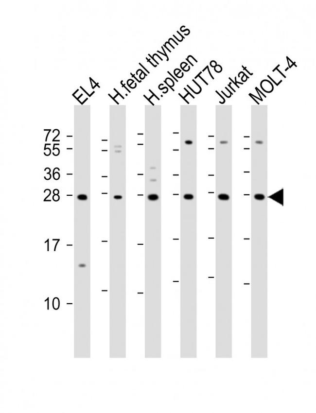 TIGIT Antibody in Western Blot (WB)