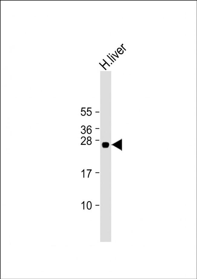 GSTA5 Antibody in Western Blot (WB)