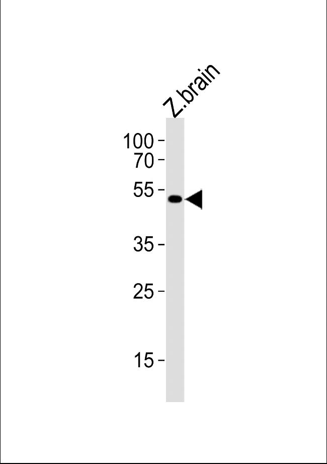 SHH Antibody in Western Blot (WB)