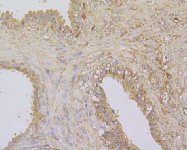 GABARAPL2 Antibody in Immunohistochemistry (Paraffin) (IHC (P))