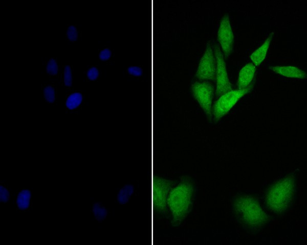 delta Catenin Antibody in Immunocytochemistry (ICC/IF)