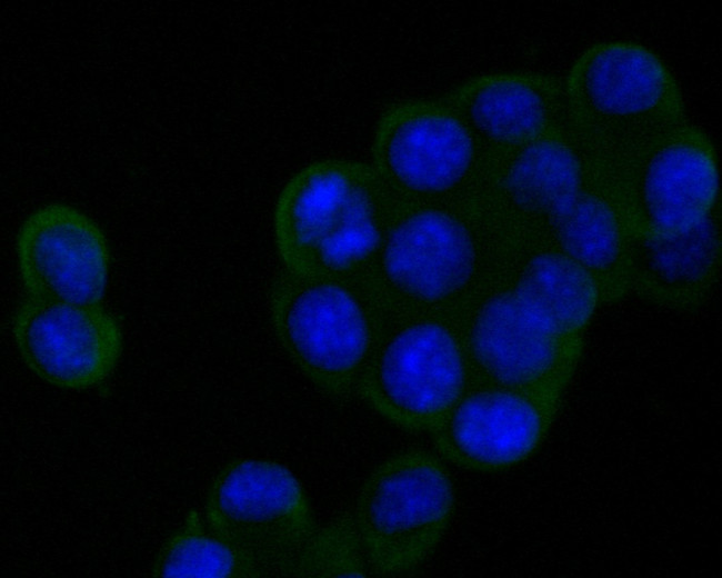 DPP6 Antibody in Immunocytochemistry (ICC/IF)