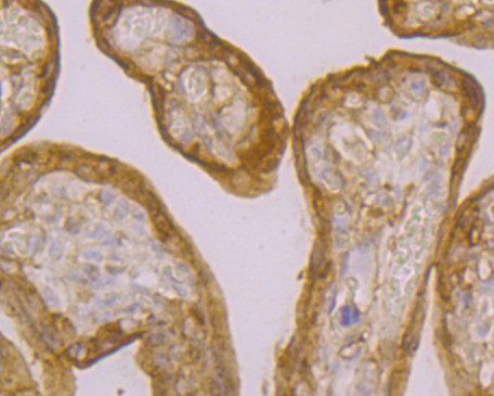 TGM2 Antibody in Immunohistochemistry (Paraffin) (IHC (P))